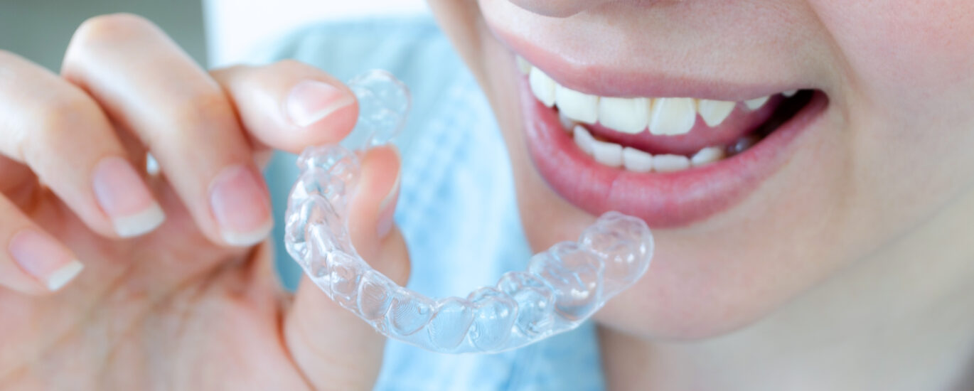 Invisalign