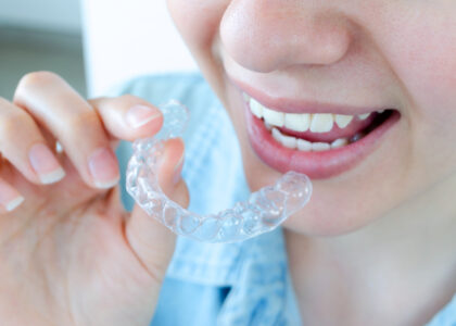 Invisalign